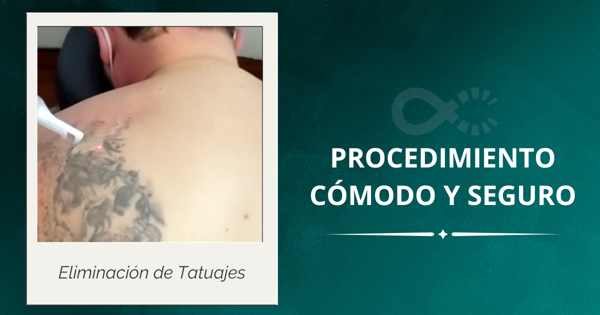 Hollywood peel-tratamiento para la piel-rejuvenecimiento facial-cleenink-ciudad de m&eacute;xico